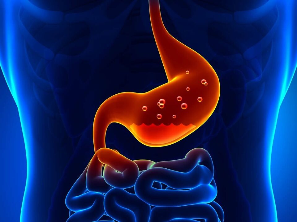Gastritis is an inflammatory disease of the stomach that requires